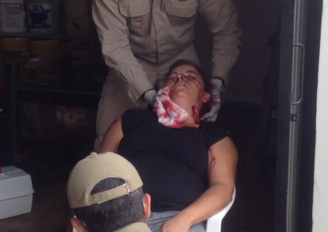 Mulher é baleada na cabeça no bairro Bodanese em Vilhena