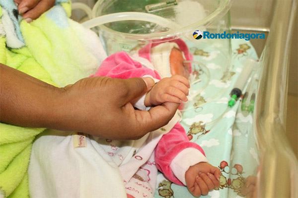 Ouro Preto:Bebê nasce sem cérebro e continua vivo;caso tem chamado atenção de médicos