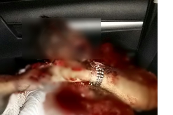 CAMPO NOVO: Fazendeiro é executado a tiros por elementos encapuzados na porteira de sua propriedade