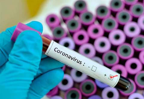 Edição 25 – Boletim diário sobre coronavírus em Rondônia