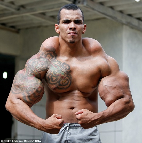 Brasileiro quase teve que amputar os braços após aplicar “bomba” para ter músculos do Incrível Hulk