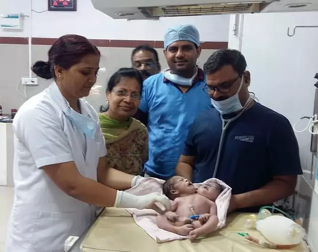Bebê indiano nasce com duas cabeças e três braços